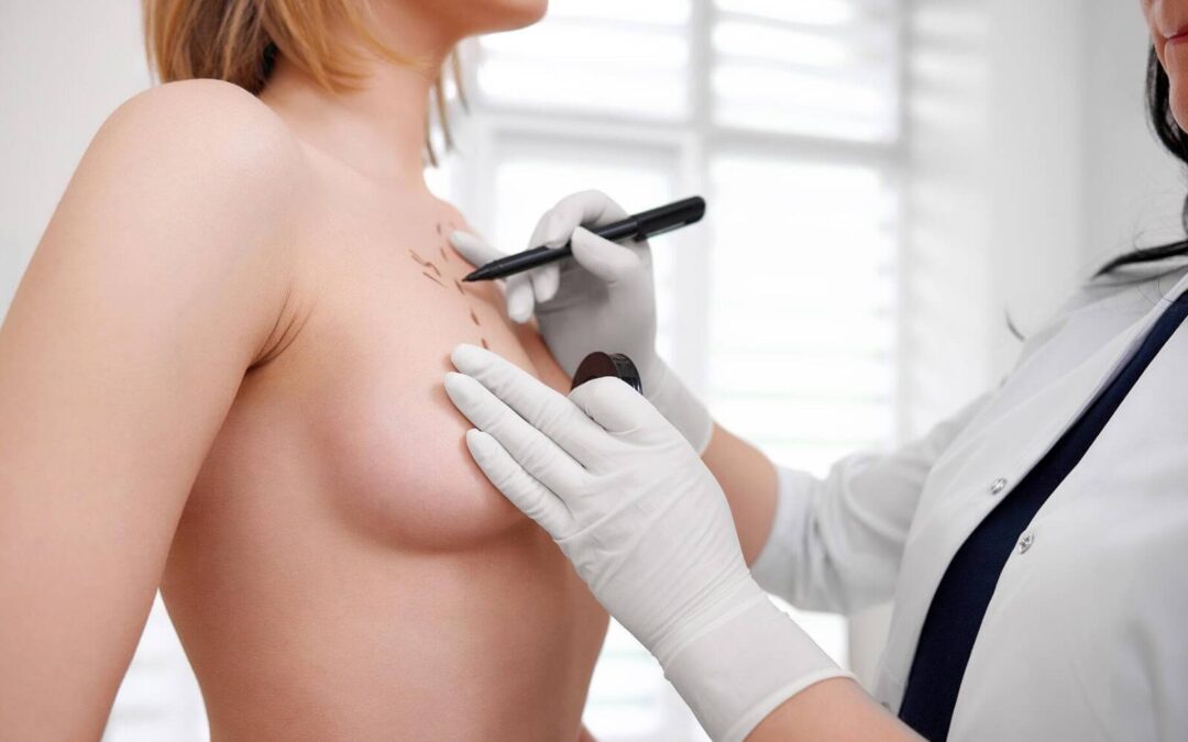 What impact can breast augmentation have on breastfeeding and mammograms?