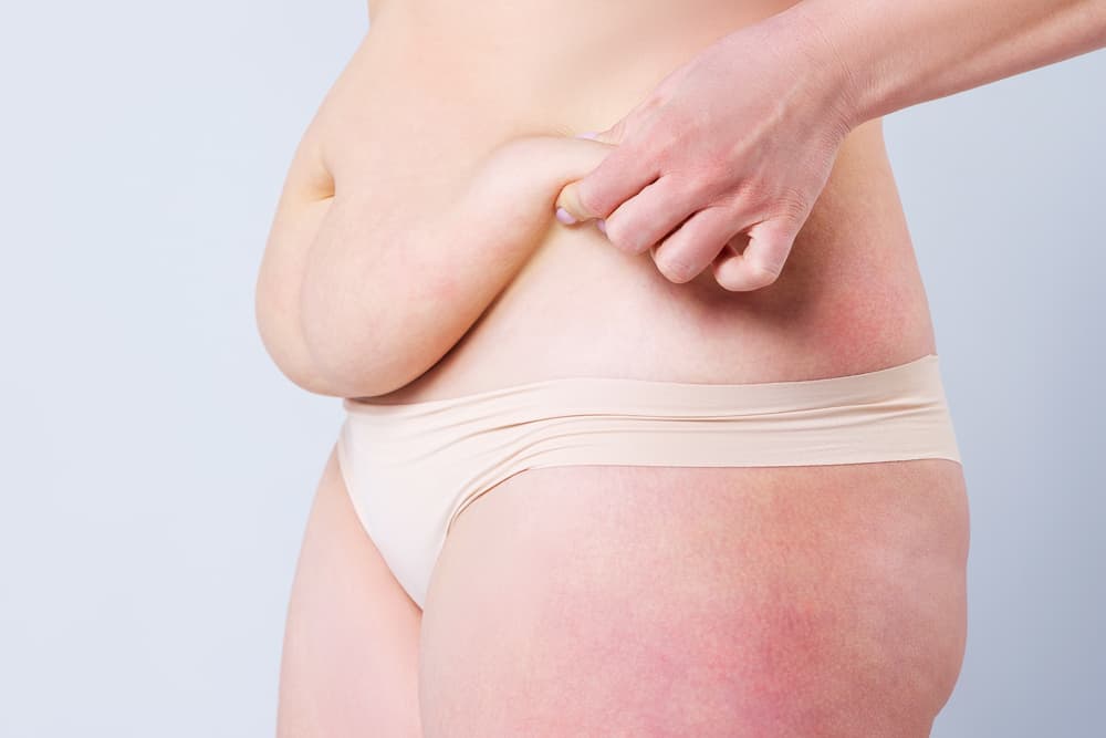 Healing in Progress: Your Guide to Liposuction Abdomen Recovery