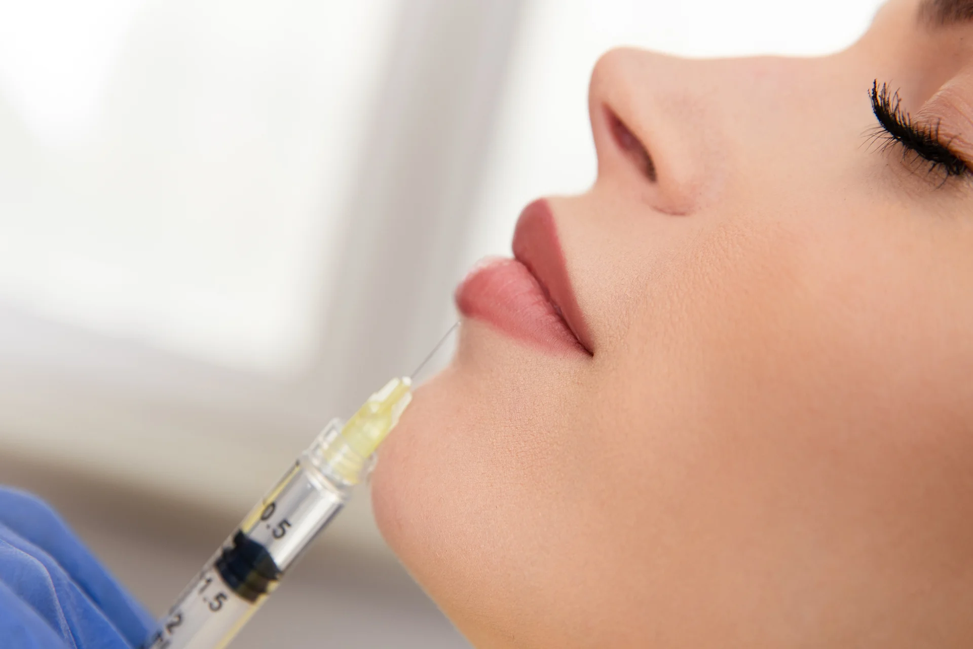 Lip Augmentation Filler: Types, Benefits & Key Considerations